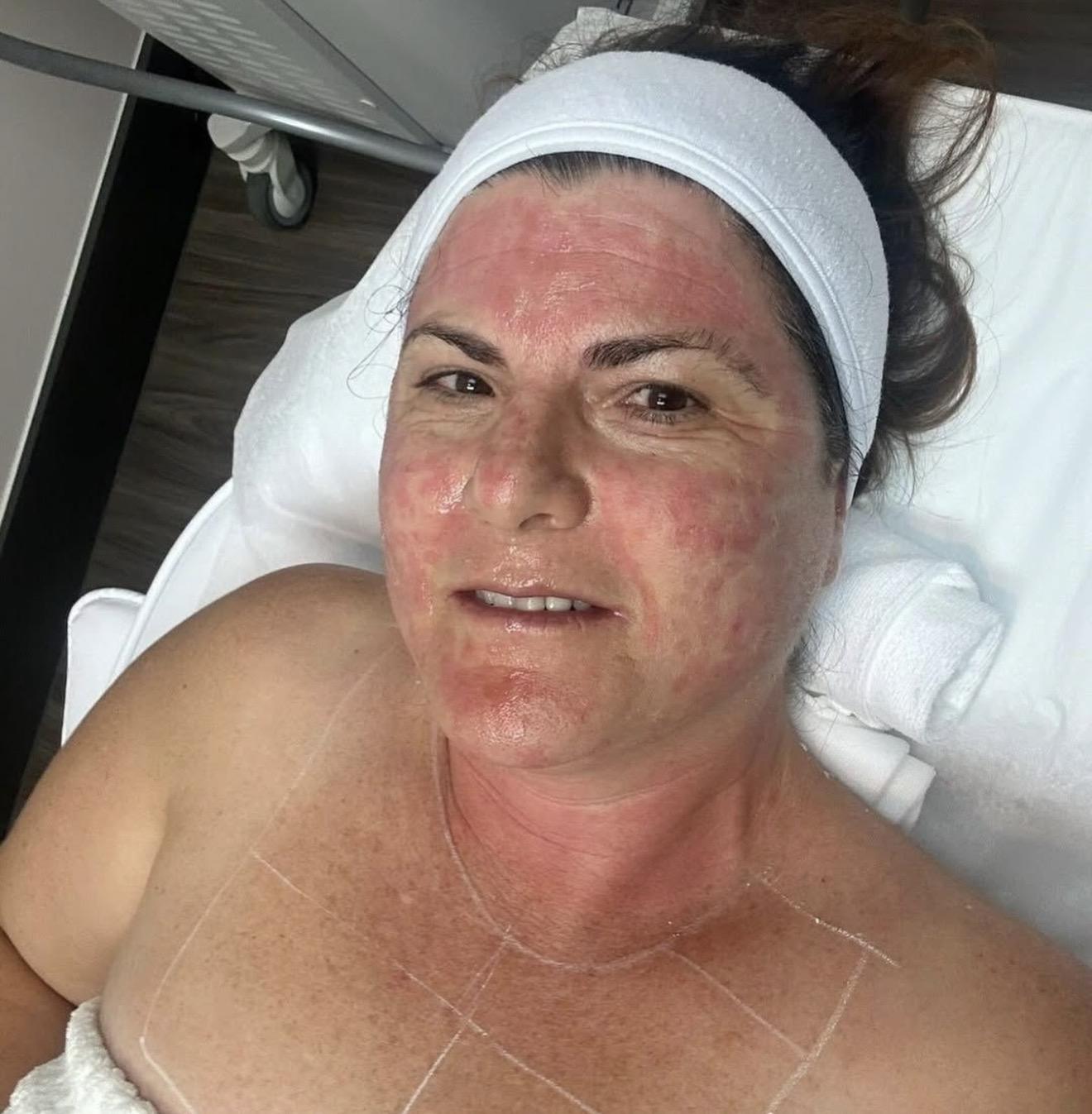 Clinical aesthetician performing an advanced skin assessment